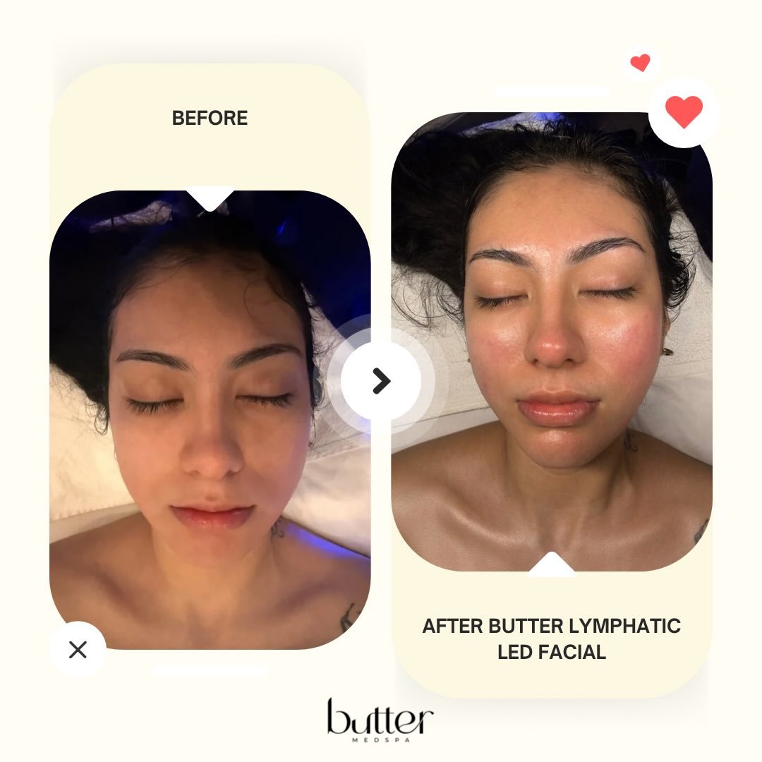 Snatched. Sculpted. Glowing. ✨

Our Butter Lymphatic LED Facial&trade; is designed to depuff, sculpt, and bring instant radiance to the skin while supporting healthy lymphatic drainage.

Paired with LED therapy to calm inflammation and boost your glo