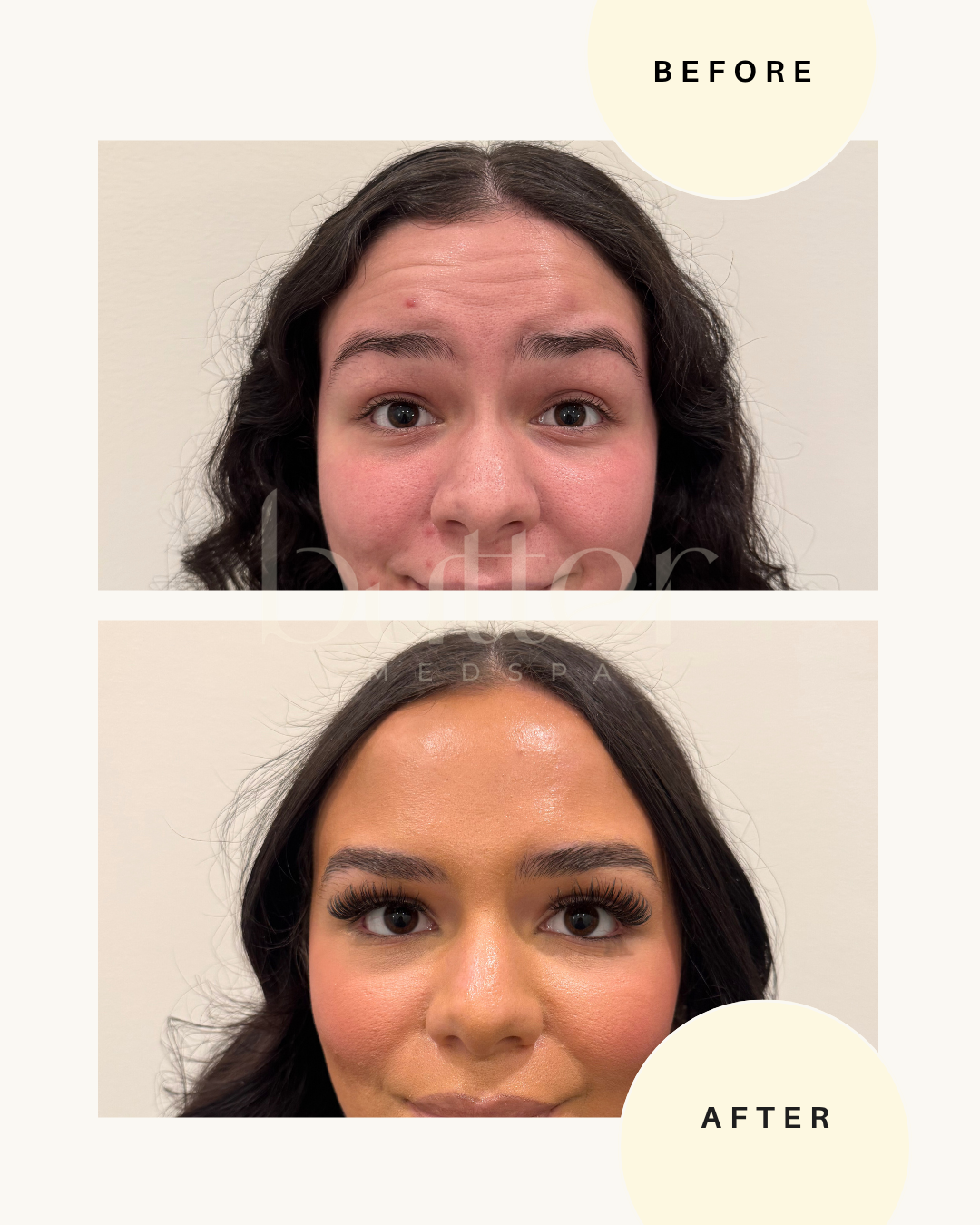 Daxxify long-lasting wrinkle treatment Englewood NJ medspa