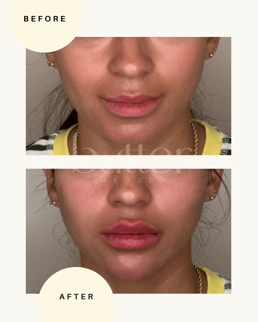 full facial balancing NJ medspa