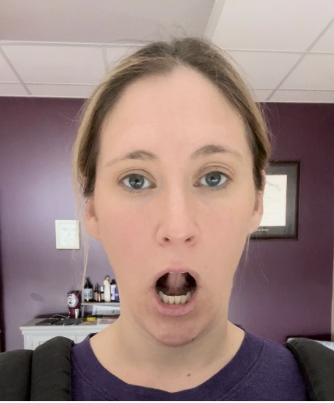 Proper jaw opening to reduce tension and improve functional opening of the jaw for less pain with chewing/yawning