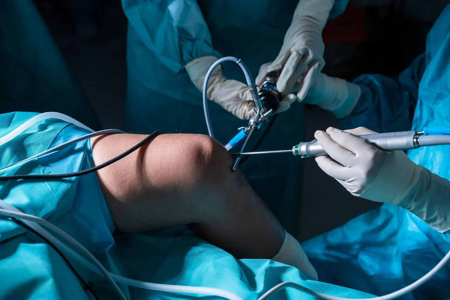 Arthroscopy & Sports Surgery