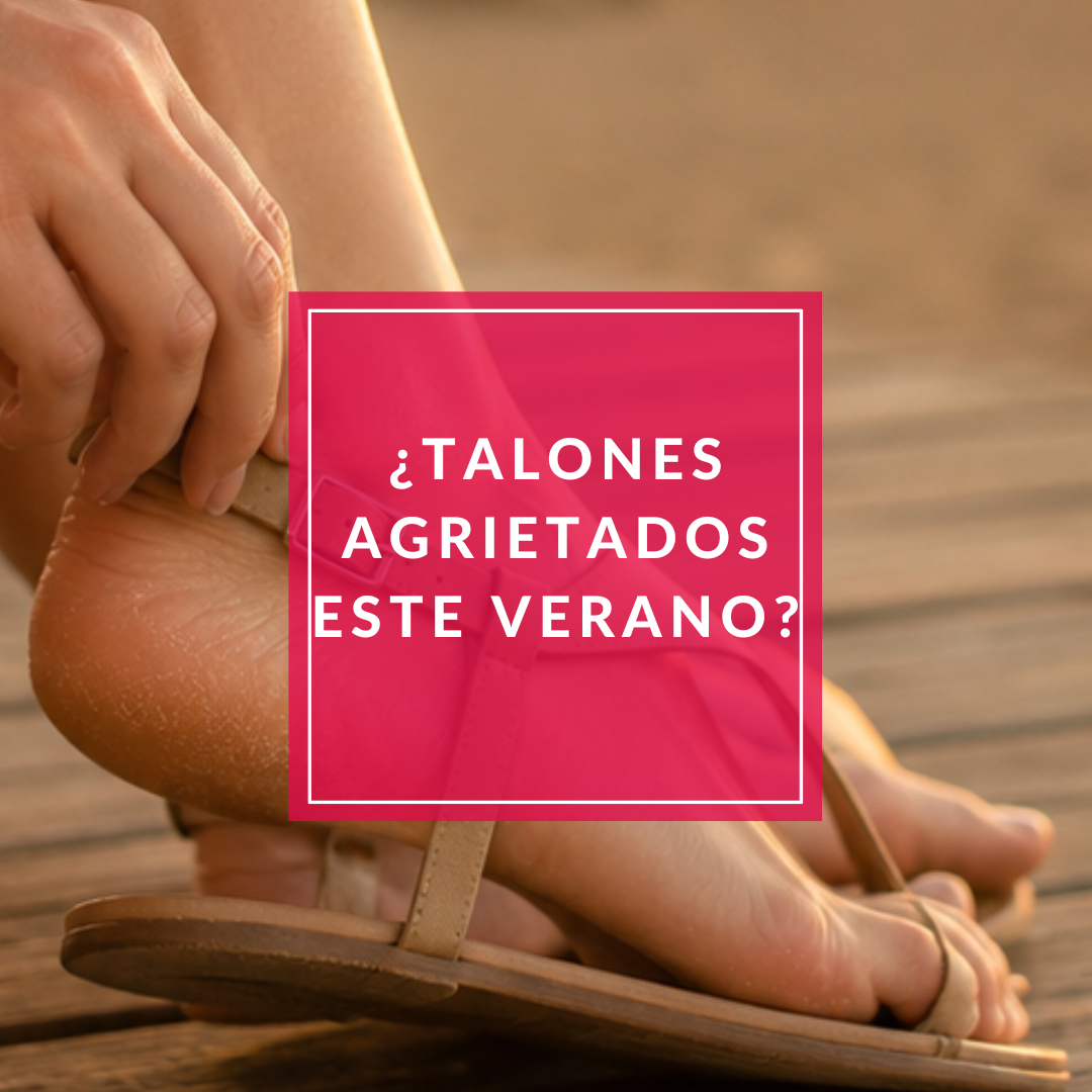 ¿Por qué aparecen grietas en los talones durante el verano?
