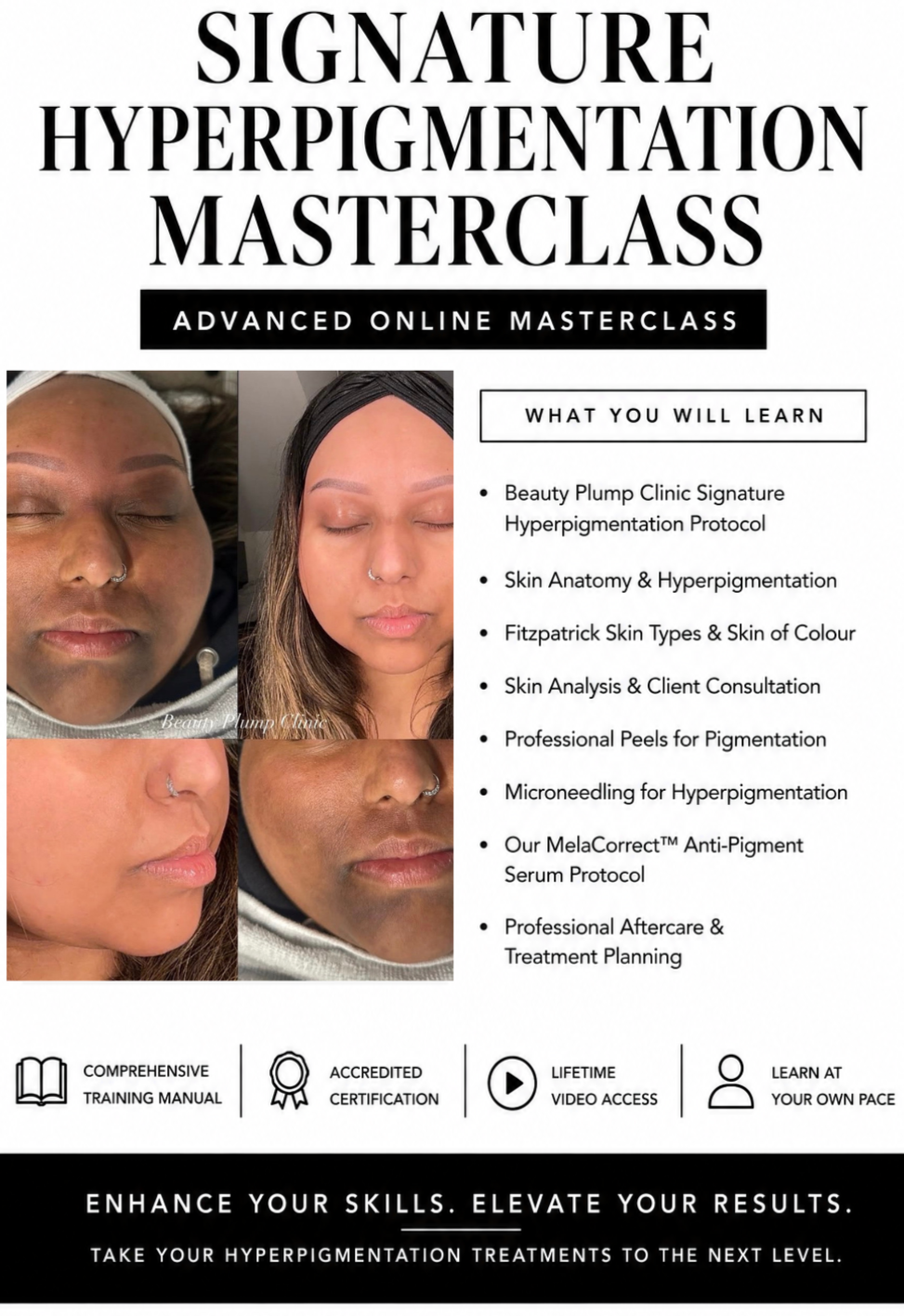 Signature Hyperpigmentation Online Masterclass