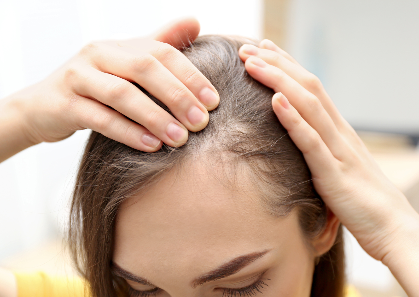 Can Mounjaro Cause Hair Loss?