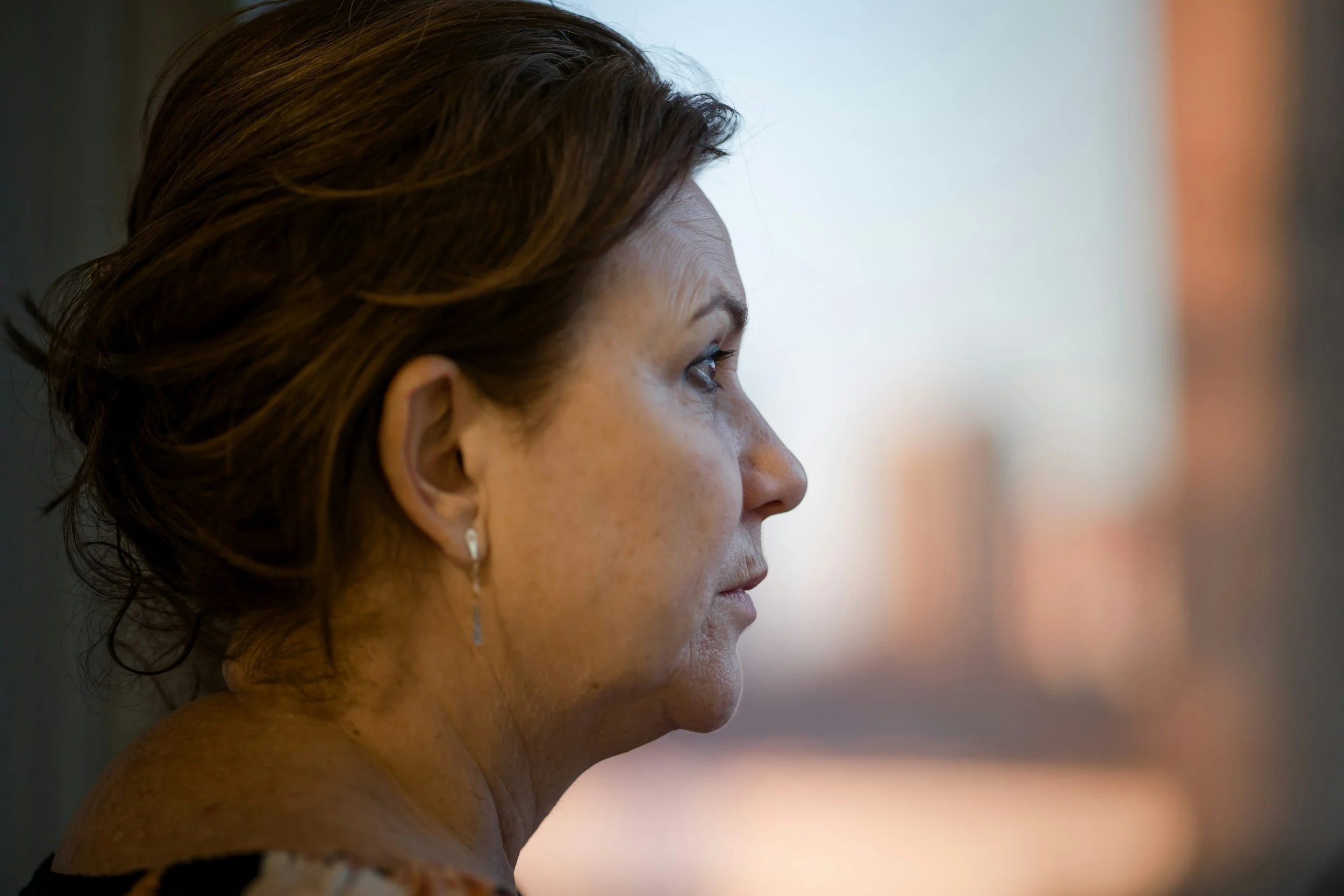 Woman experiencing perimenopause hair loss, trichologist Ruth Collis in Haywards Heath explains what's happening and what helps
