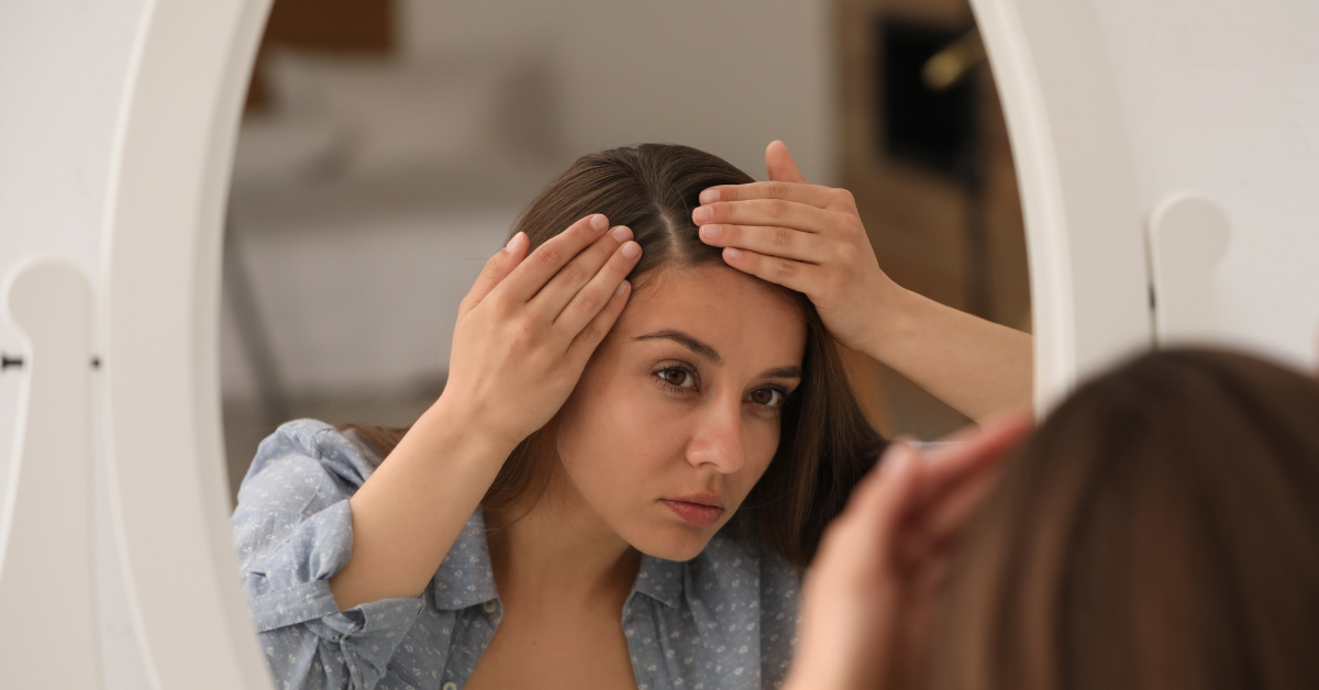Woman with thinning hair at the parting — trichologist in Haywards Heath discusses female hair loss