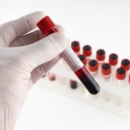 How Long Do Private Blood Test Results Take?