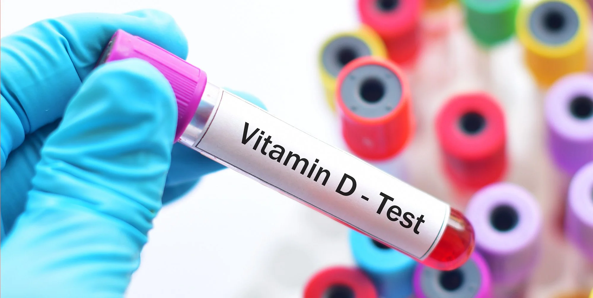 Do I Need a Vitamin D Test This Winter? What Grimsby Residents Should Know