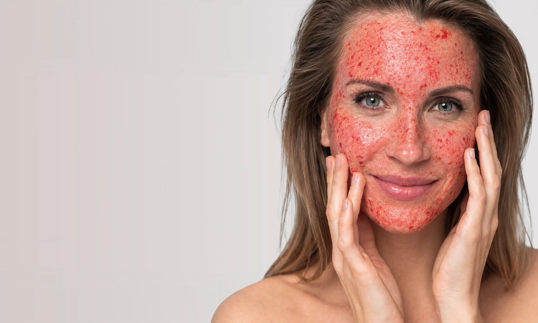 Woman received vampire facial in st catharines at Contour Medical Aesthetics & Wellness with Licensed Nurse Practitioner Cassie Cimino