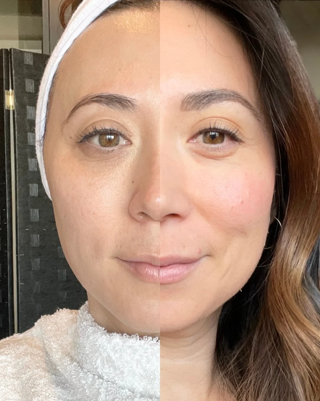 60 years of proof, and still one of the most trusted methods in natural skin renewal &mdash; the Original Green Peel&reg; 🌱

Developed by Dr. Schrammek, this completely herbal treatment is clinically proven to activate your skin&rsquo;s own renewal 