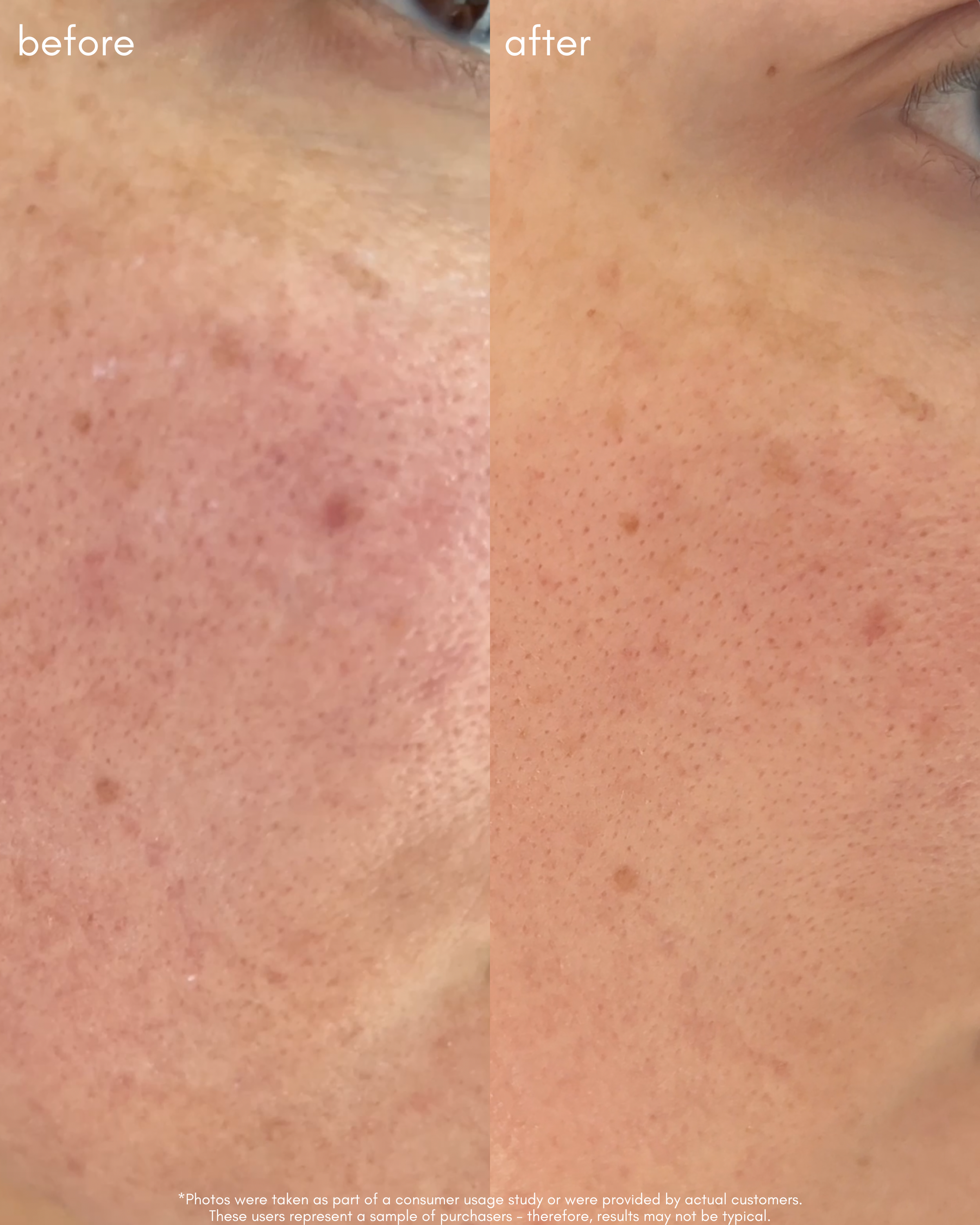 The Advanced Response Complex Before _ After 4.png