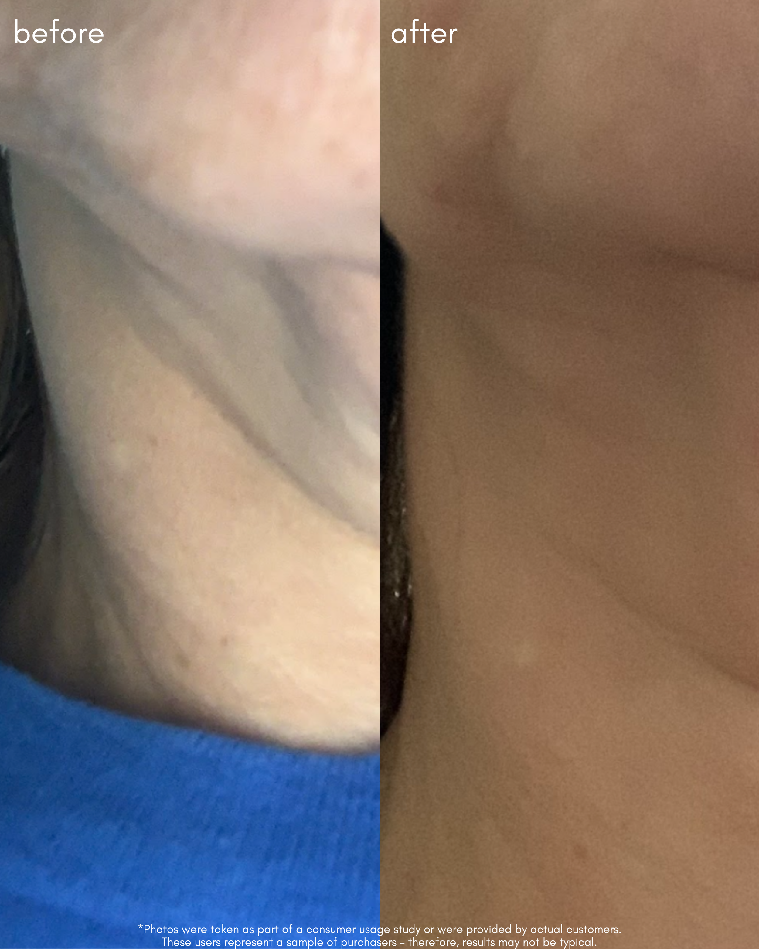 The Advanced Response Complex Before _ After 3.png