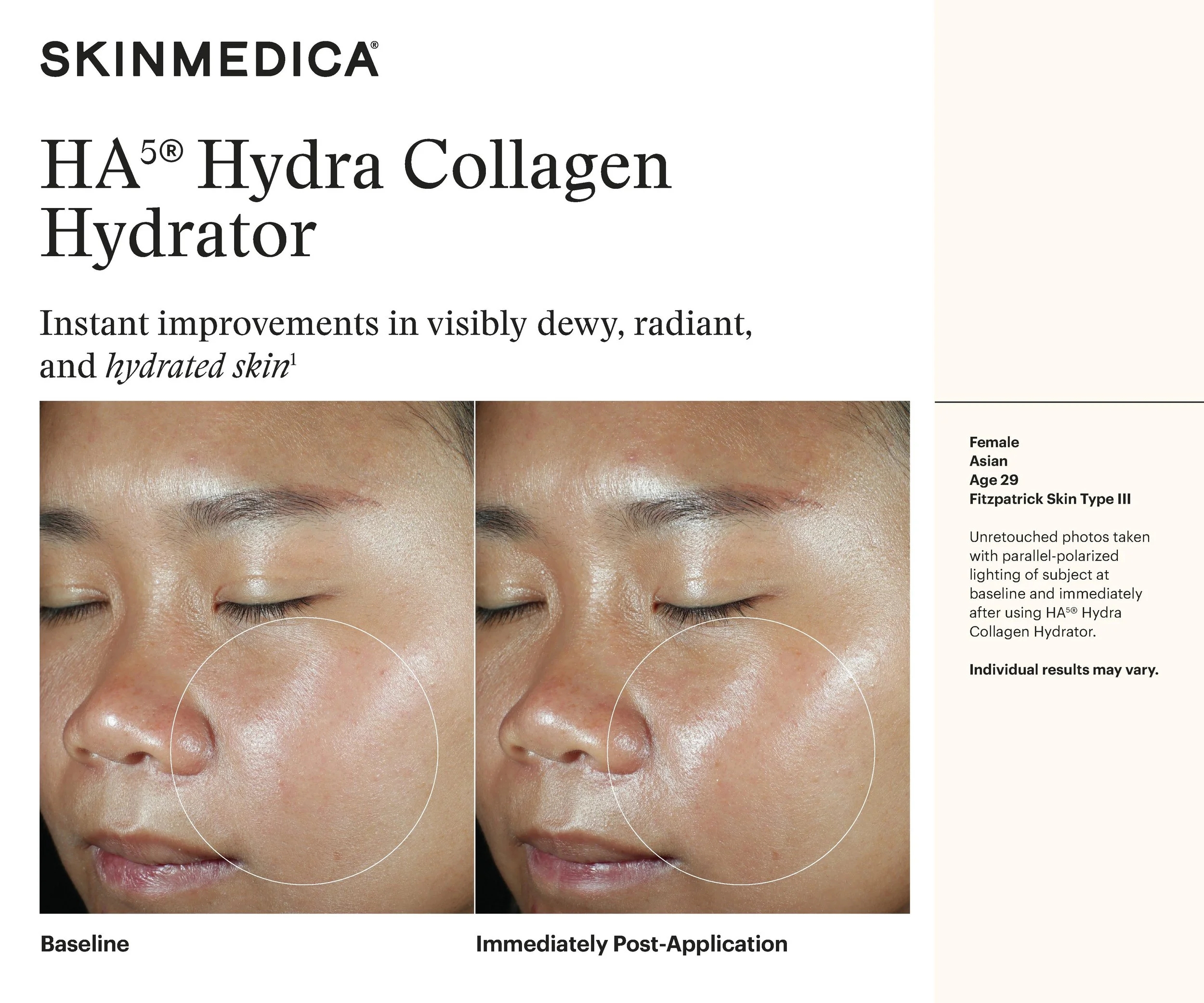 SKM_HA5 Hydrator_Immediate_FitzIII.jpg