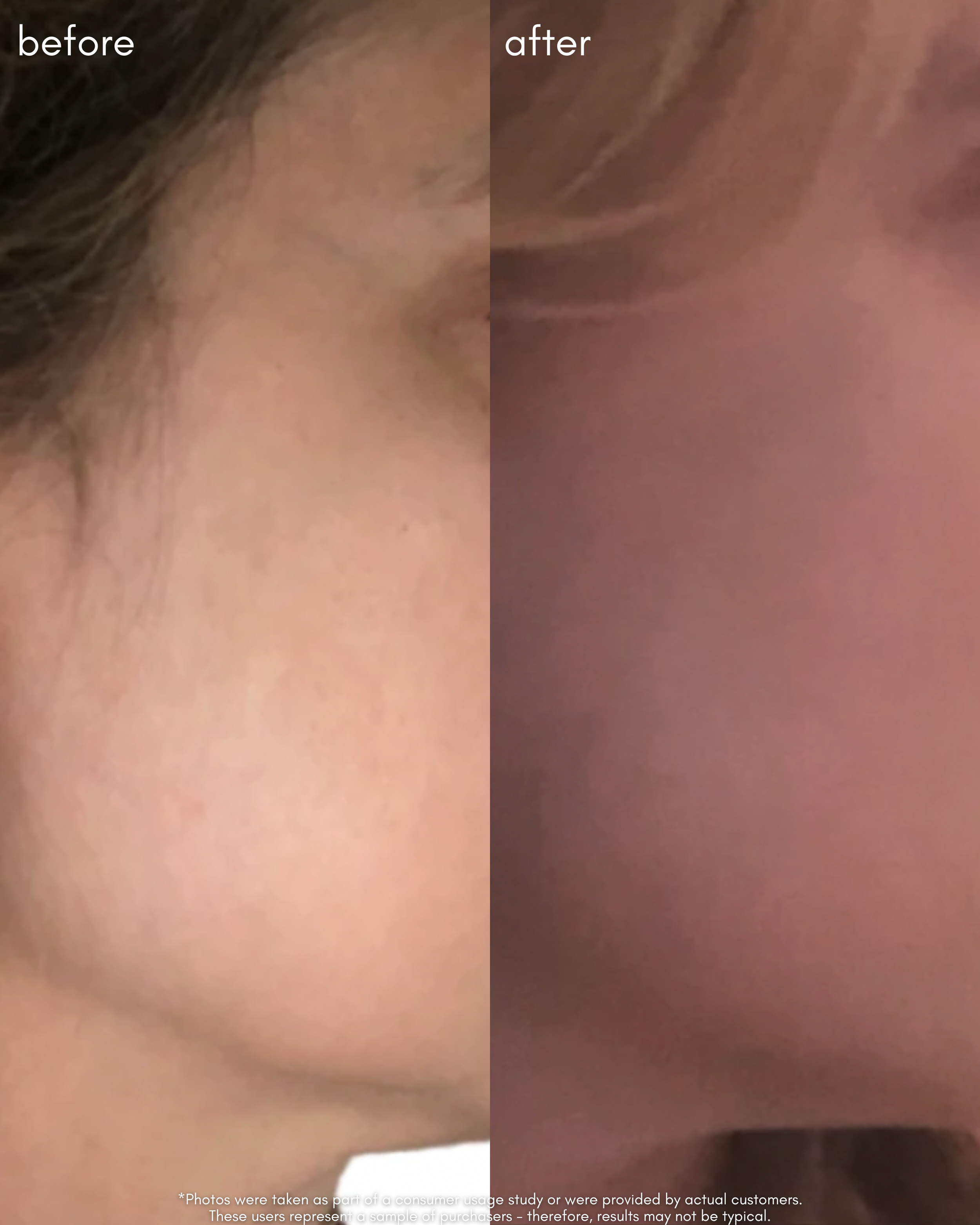 The Advanced Response Complex Before _ After 1.png