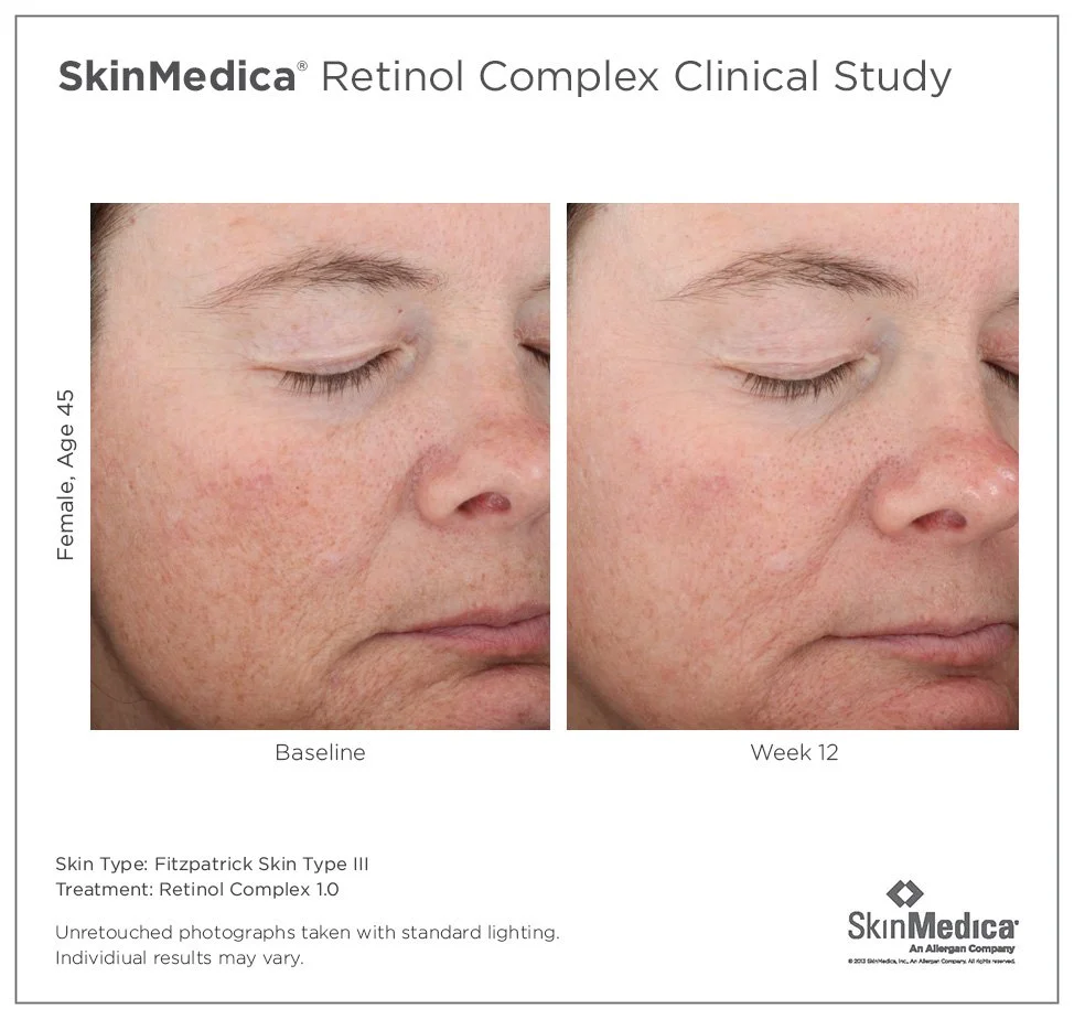 Retinol_FemaleAge45.jpg