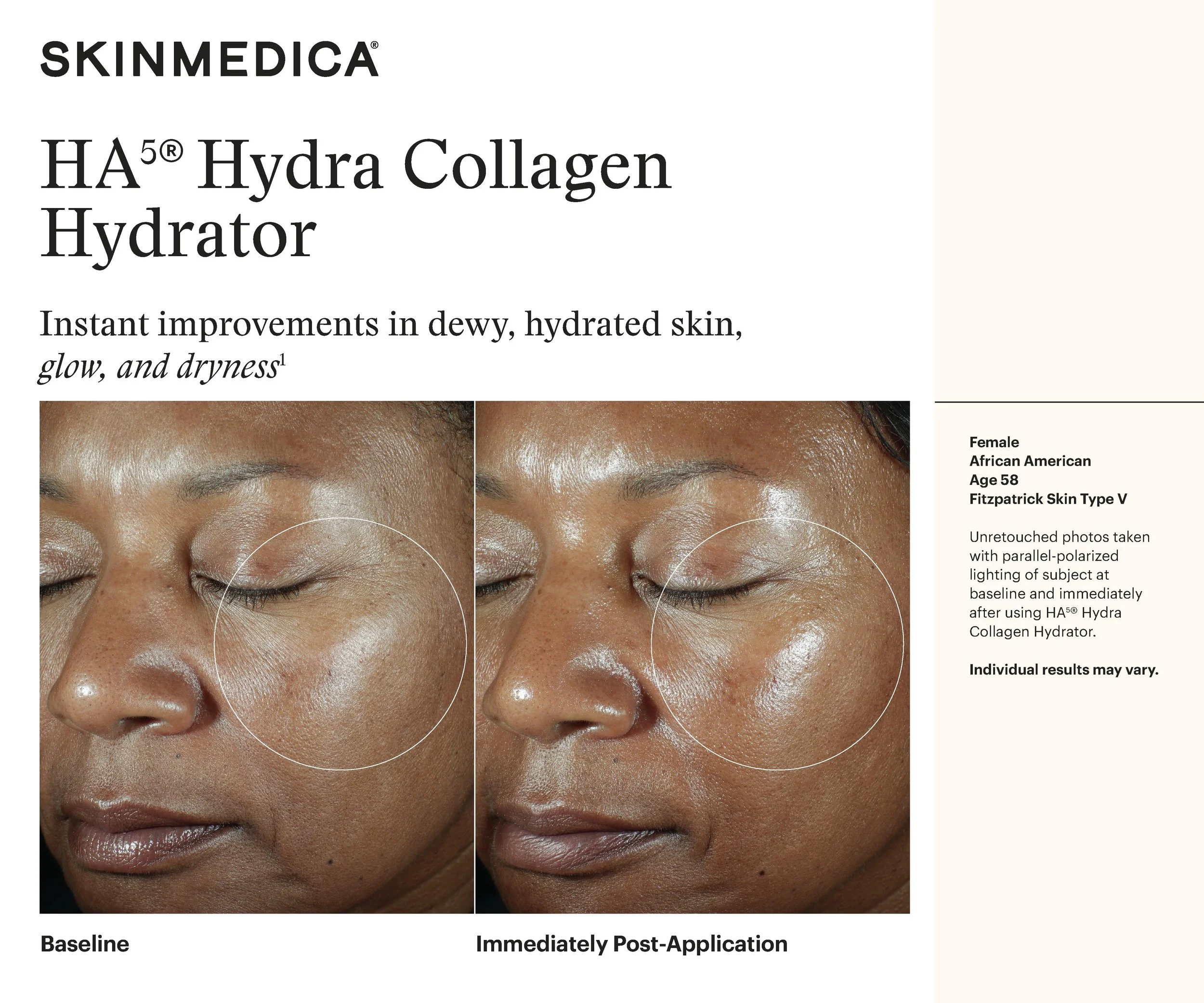 SKM_HA5 Hydrator_Immediate_FitzV.jpg