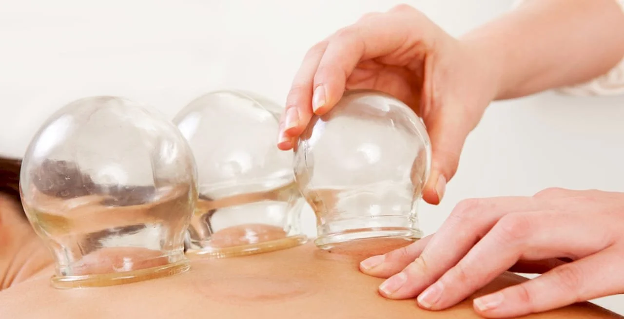 Een persoon ontvangt een cupping-behandeling met doorzichtige glazen cups op de rug.