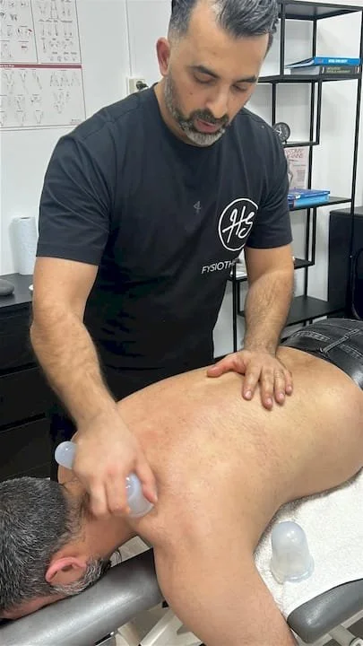 Fysiotherapeut die een man behandelt die een cupping-therapie krijgt op zijn rug