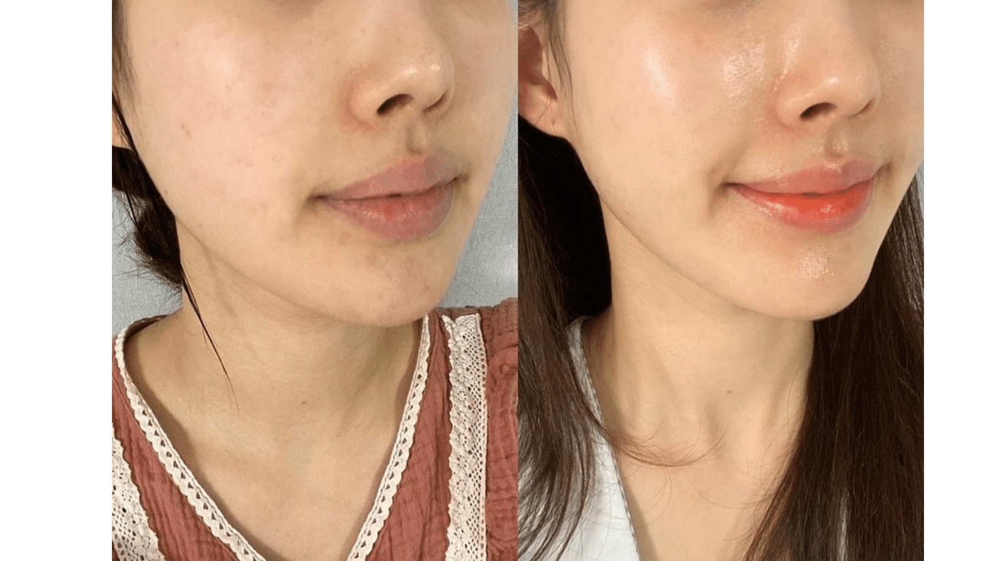 Side-by-side comparison of a woman's face before and after skincare or makeup treatment, showing smoother, glowing skin and enhanced lips in the after image.