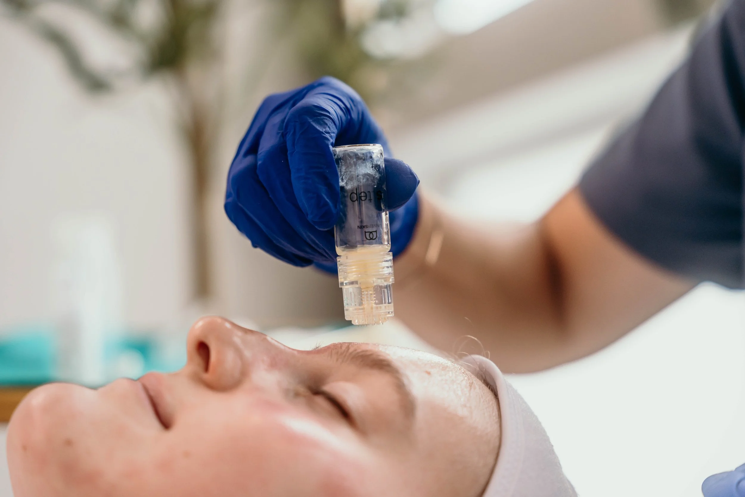 Close-up of a person receiving a facial treatment with a serum applicator held by someone wearing blue gloves.