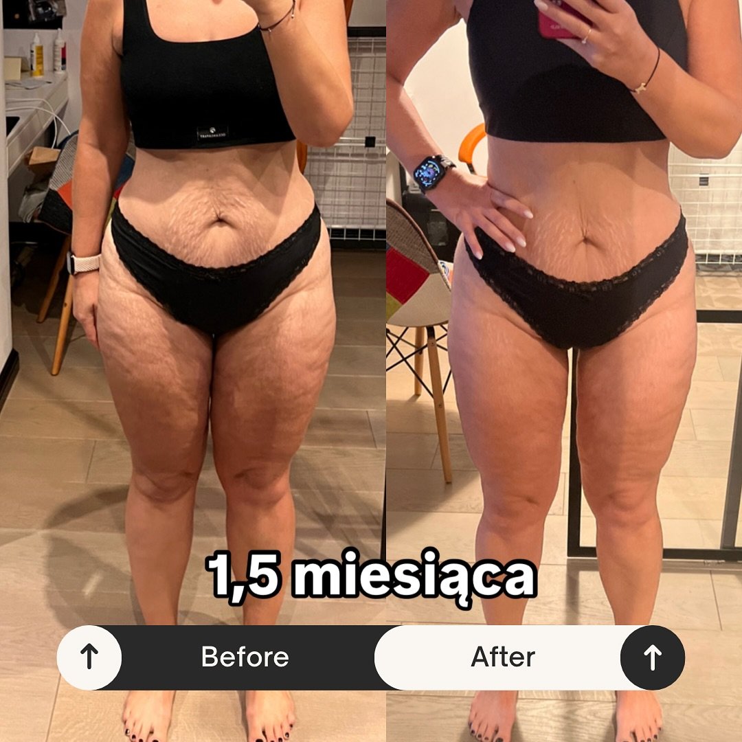 ✨ Przemiana sylwetki w 1,5 miesiąca! ✨
Na wadze tylko -1 kg, ale efekty treningu siłowego i zdrowego odżywiania mówią same za siebie! 🔥
Waga to nie wszystko – liczy się kompozycja ciała i samopoczucie. Dzięki regularnym treningom siłow