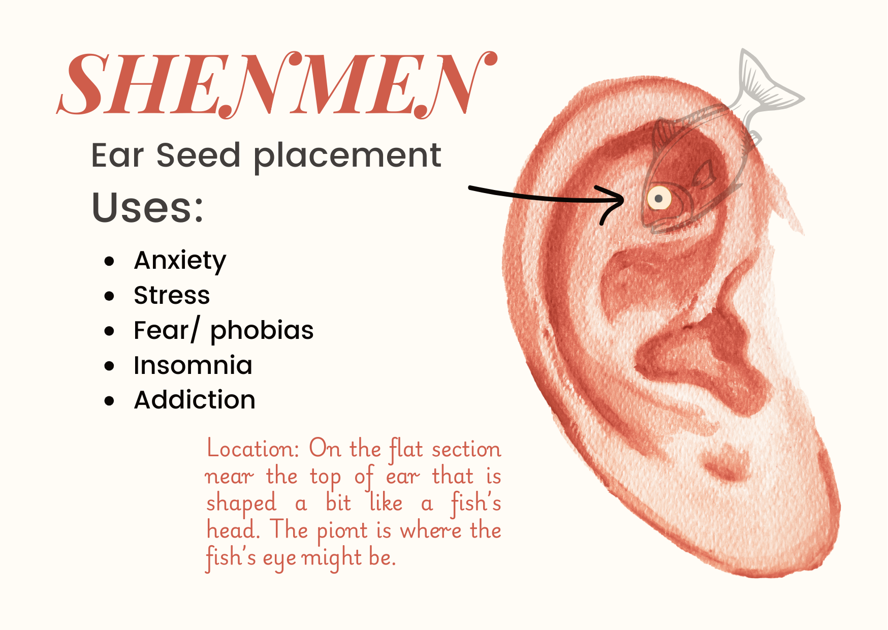 Shenmen Ear Seed Placement