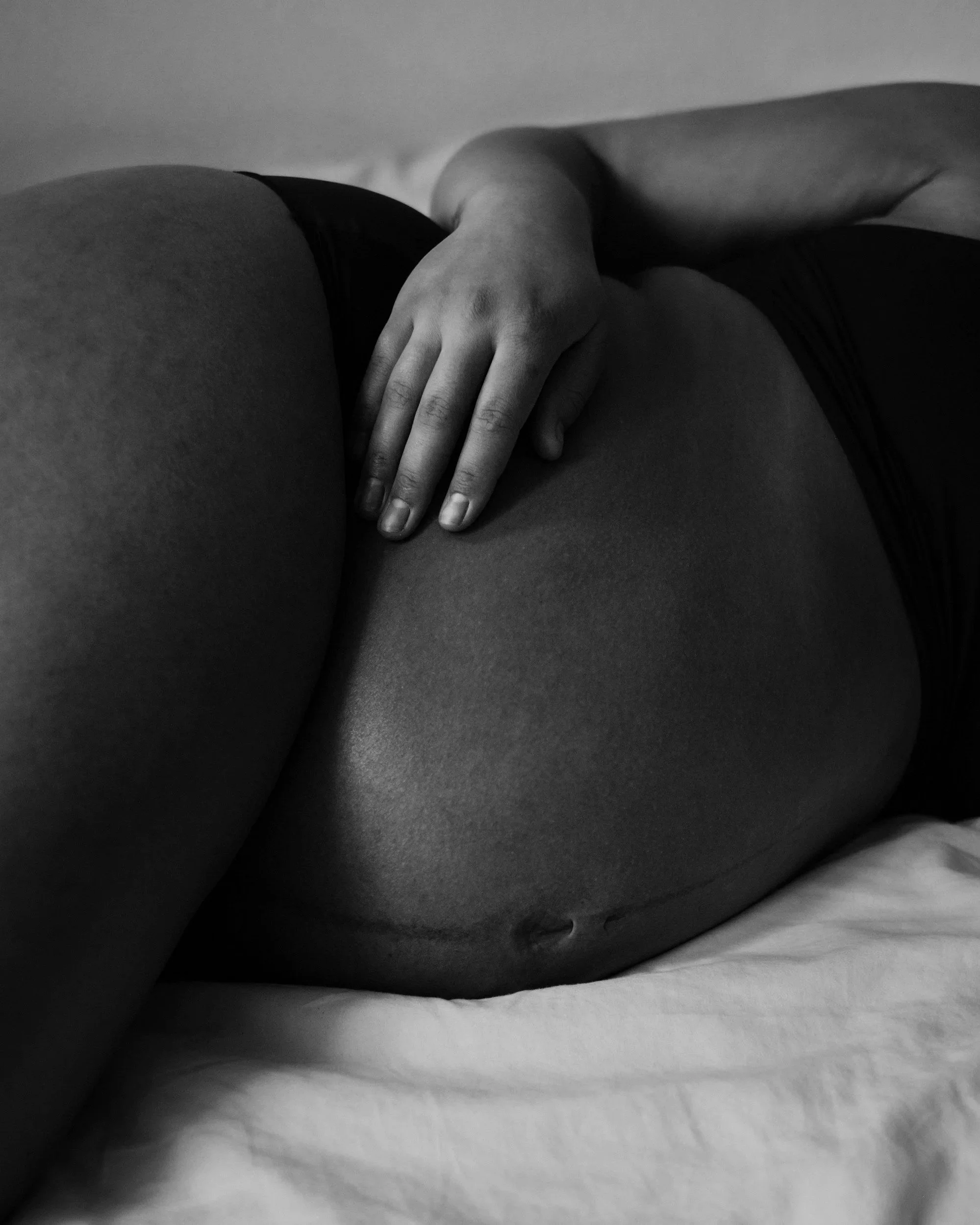 Acupressure & Assisted Insemination: a Complementary Approach to Fertility