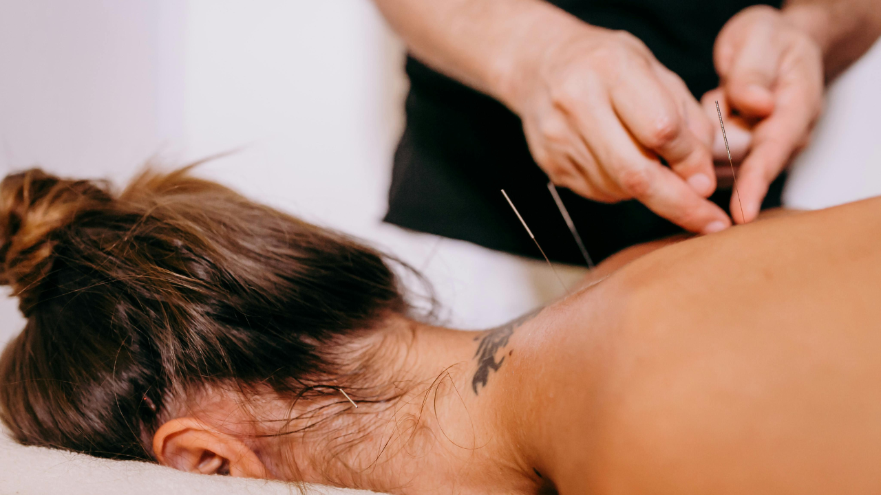 Close-up of a practitioner's hands carefully inserting fine acupuncture needles into a client’s skin during a traditional Chinese medicine session