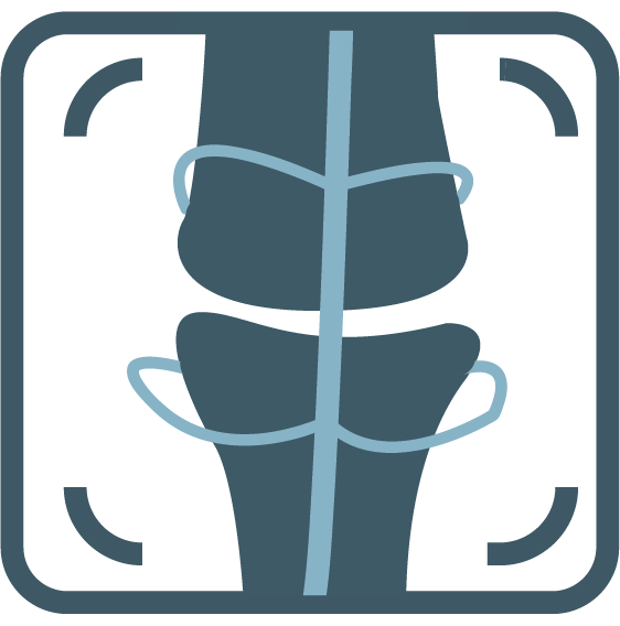 Musculoskeletal