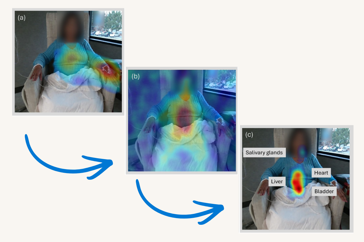 Advancing real-time organ-specific visualisation with RAVIN CAM