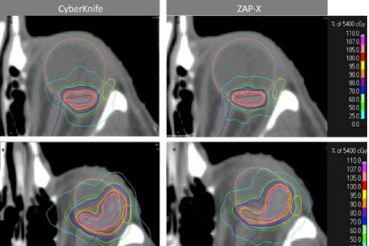 New evidence supporting ZAP-X in uveal melanoma