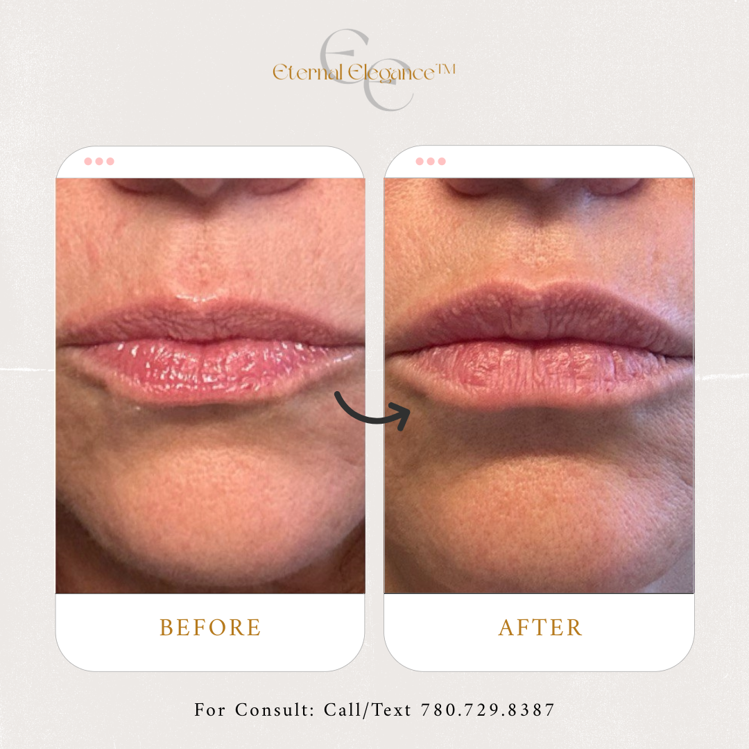 Eternal Elegance-38 (2).png