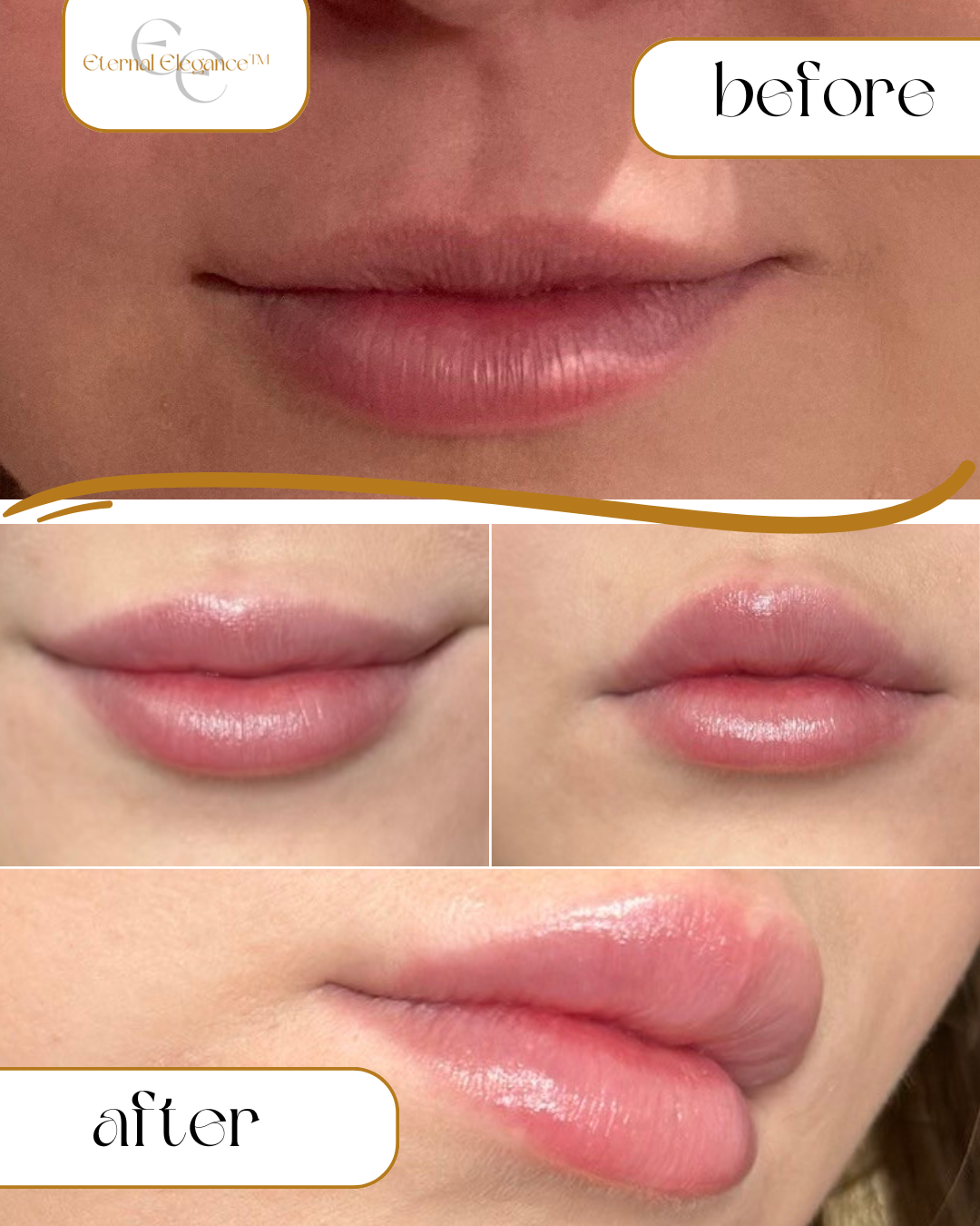 Patient 1 - Combined (1).png