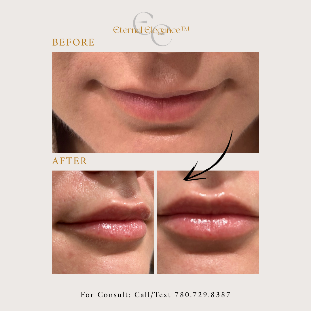 Eternal Elegance-40-B-A Patient 3.png