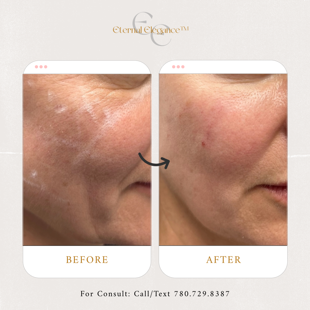 Eternal Elegance-39-B-A Patient 4.png