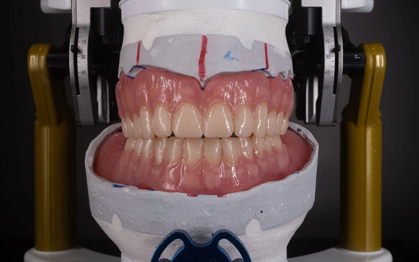 Full set of artificial teeth with gums displayed on a dental model.