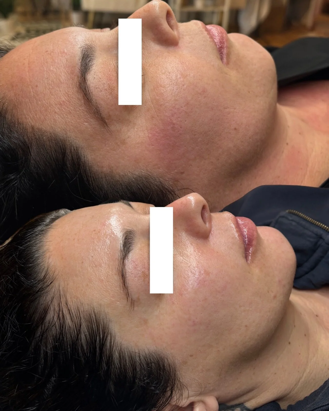 Only a month a part 👏🏽

She&rsquo;s never had a facial before or a set homecare routine, so I&rsquo;m grateful she found me. It&rsquo;s amazing how skincare can really make you look younger! We started her first chemical peel series today.. I can&r