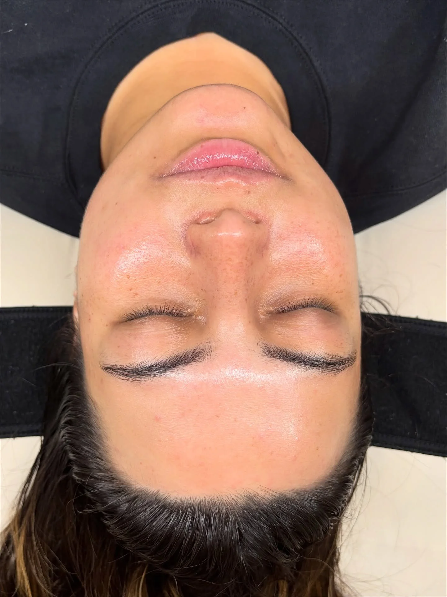 My client came to me in January with eczema flare ups, dry skin, and a compromised barrier. We focused on healing &amp; hydrating her skin, as well as a home skincare routine. She&rsquo;s followed my advice and now her skin looks amazing&mdash; liter