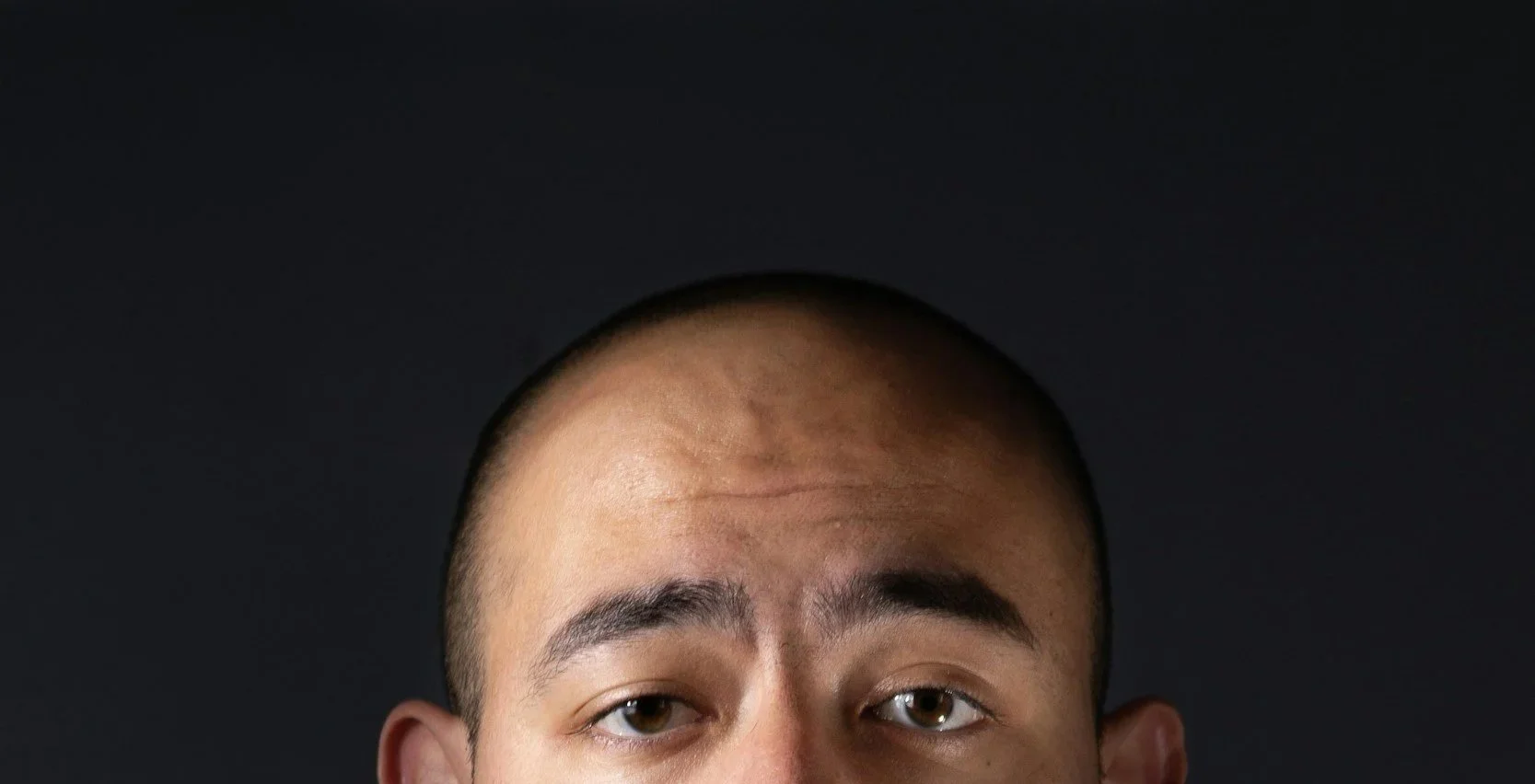 Close-up of a person's forehead with visible skin texture, some small blemishes, and sparse eyebrow hairs.