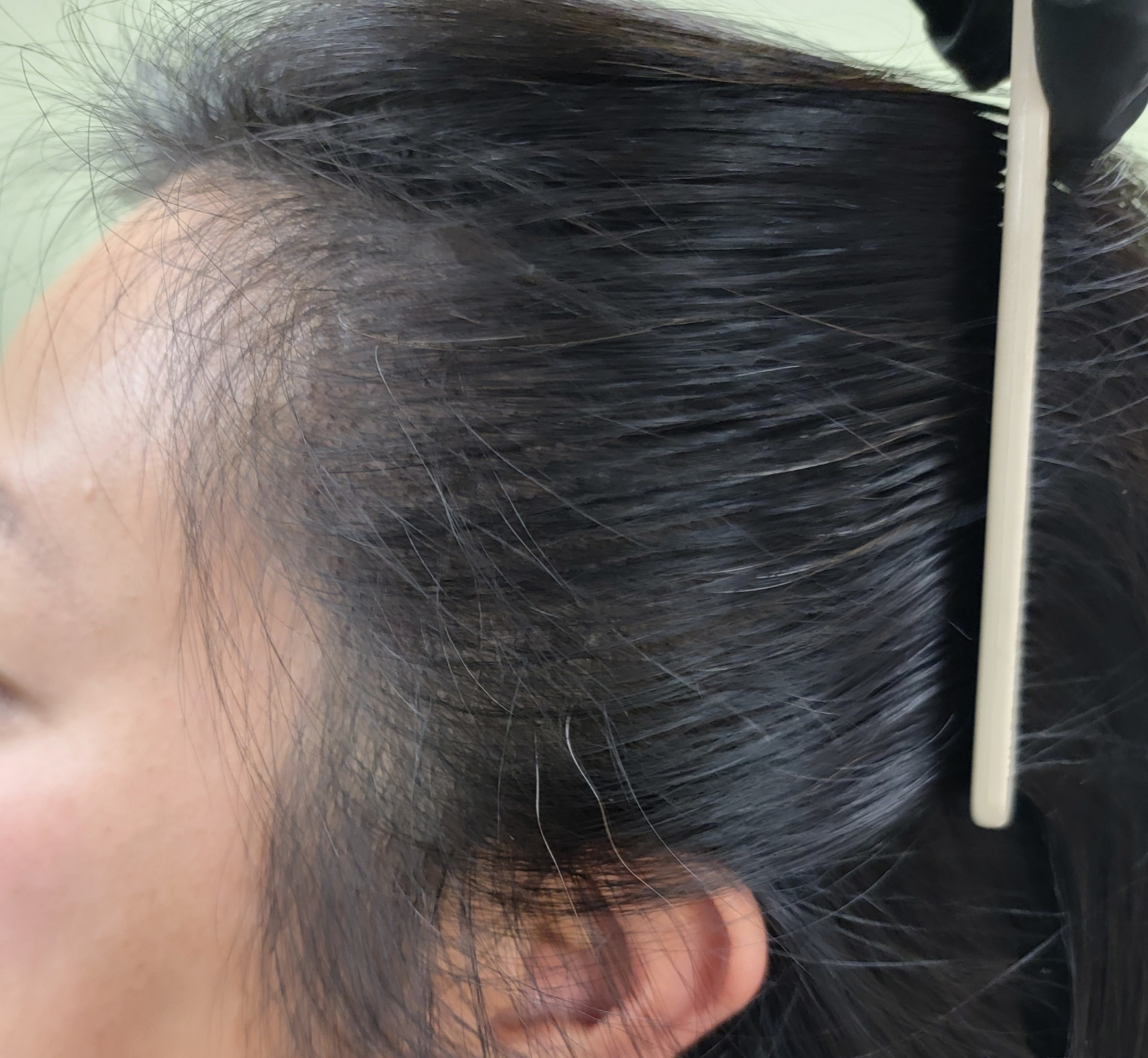 Close-up of a woman's gray hair experiencing hair loss at crown.
