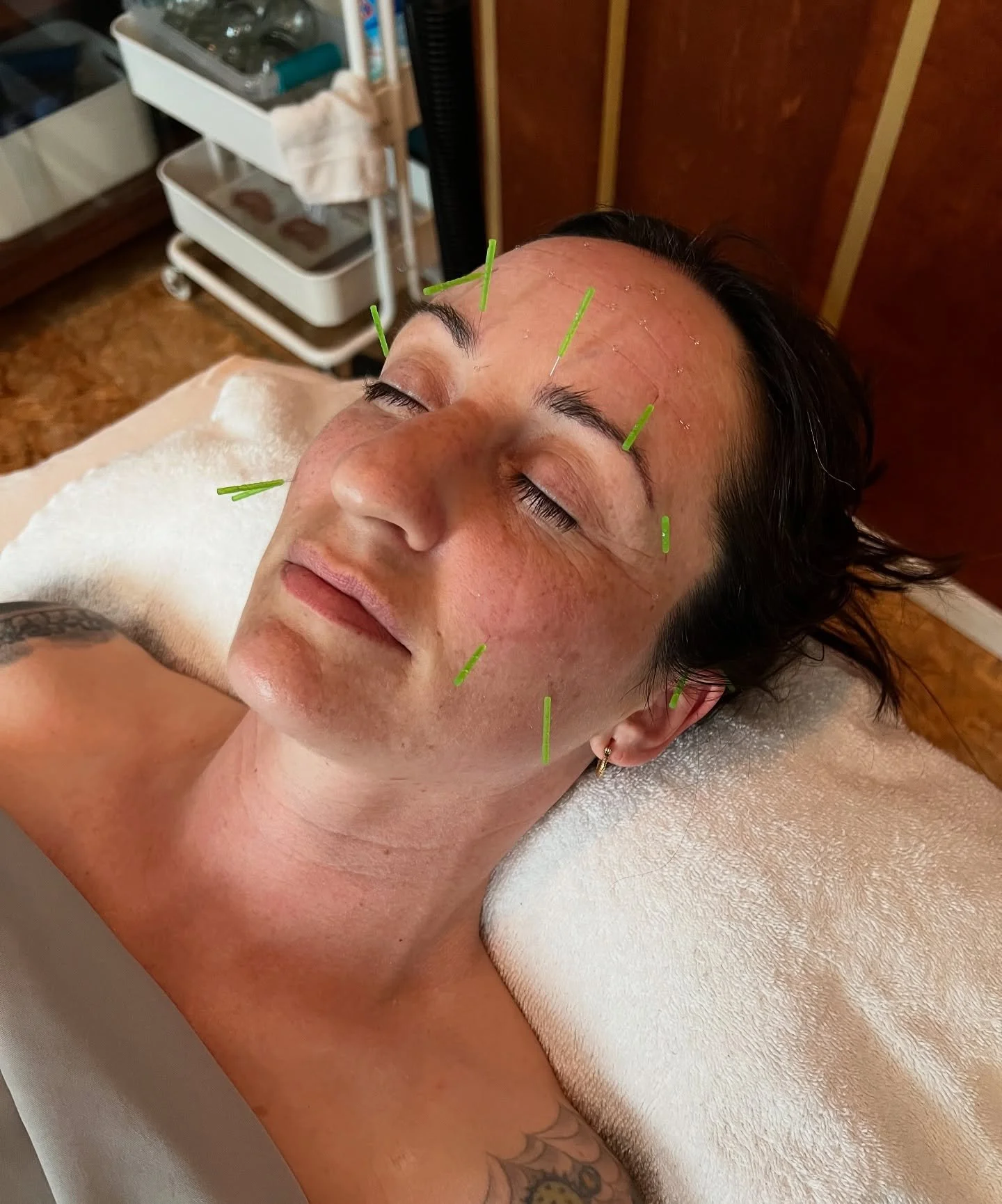 ✨FACIAL ACUPUNCTURE ✨

Emily from @alamanoskincare came in this week for her first facial acupuncture session (also referred to as &ldquo;cosmetic acupuncture&rdquo;). She noticed a significant &ldquo;lifting&rdquo; of the facial muscles and increase