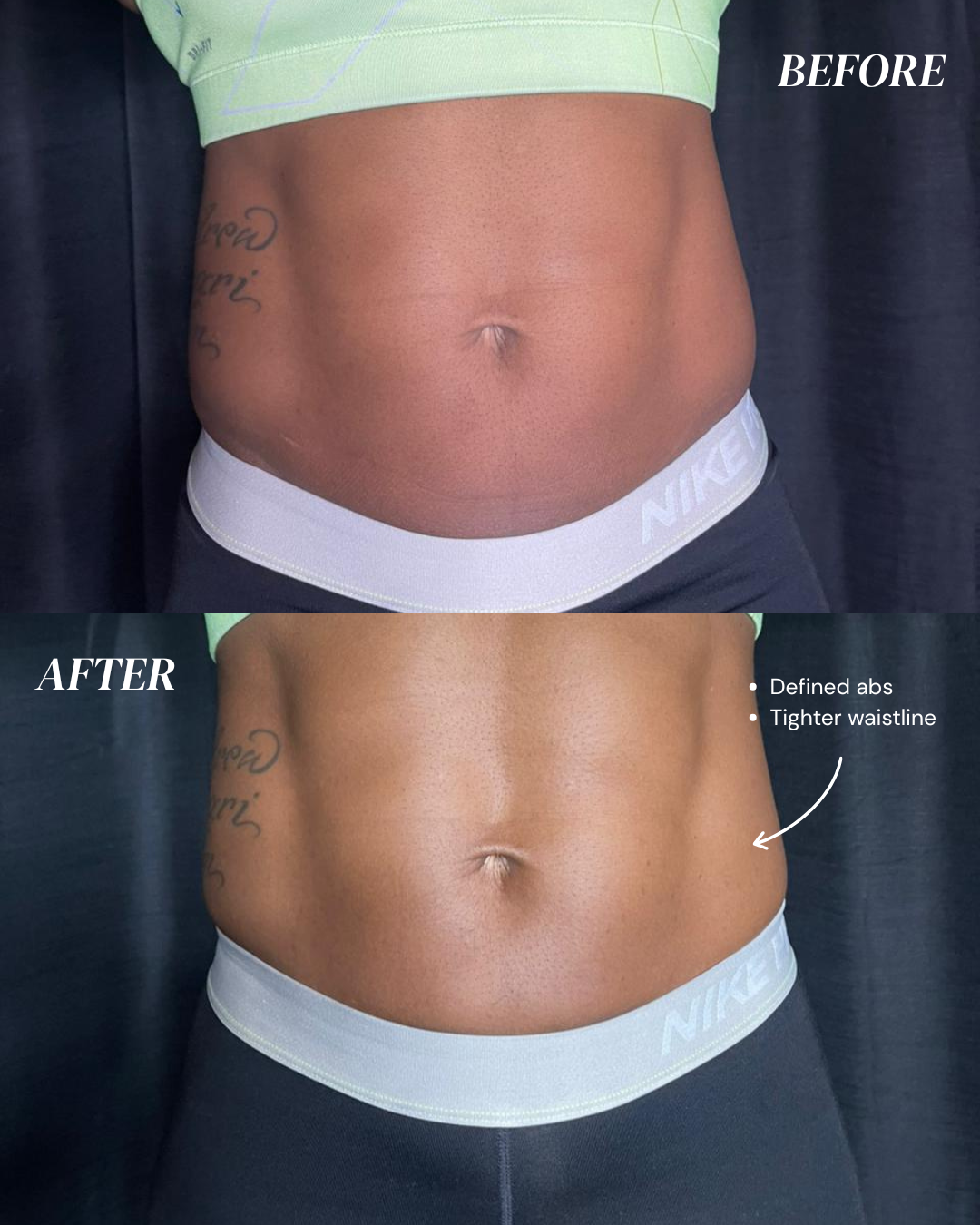 Body Yadi Tummy (1 Session) 