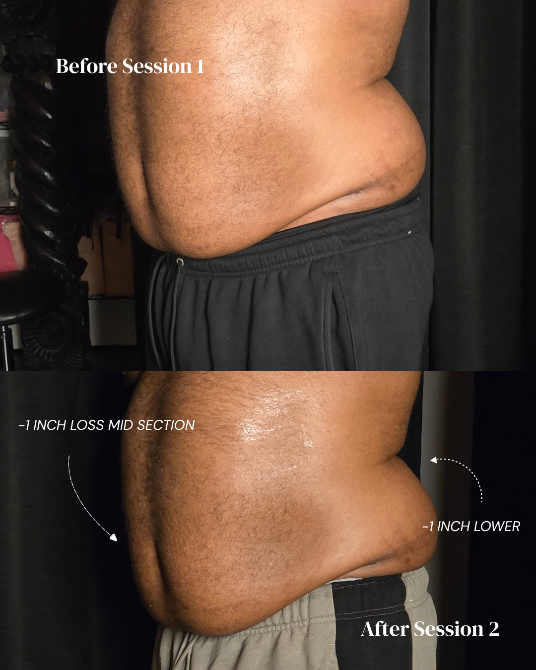 Body Yadi Tummy (2 Sessions)