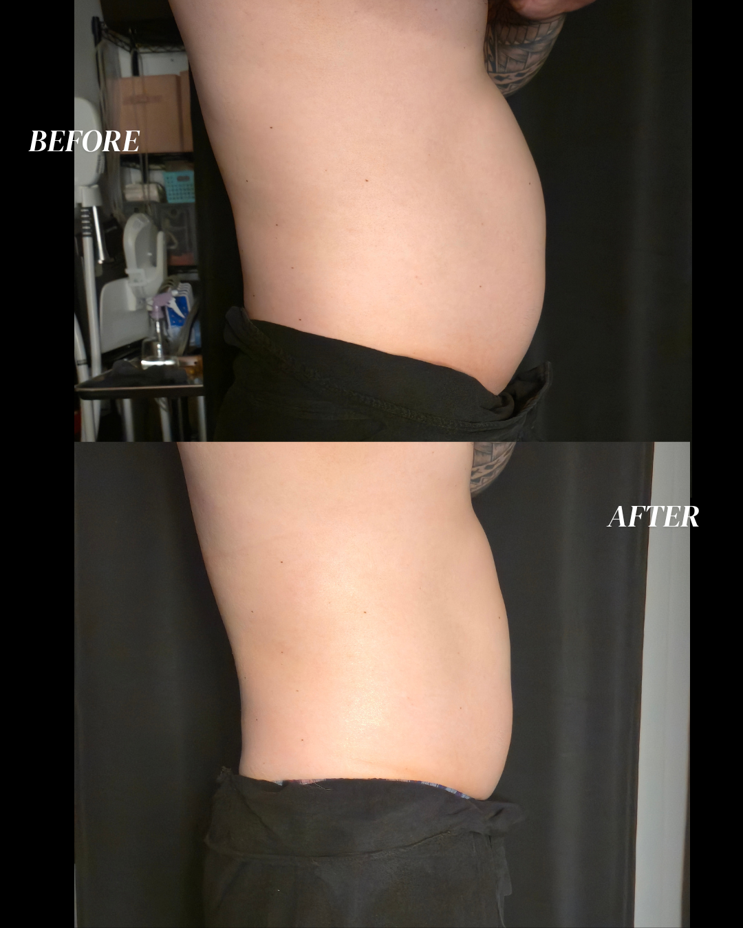 Body Yadi Tummy (1 Session)