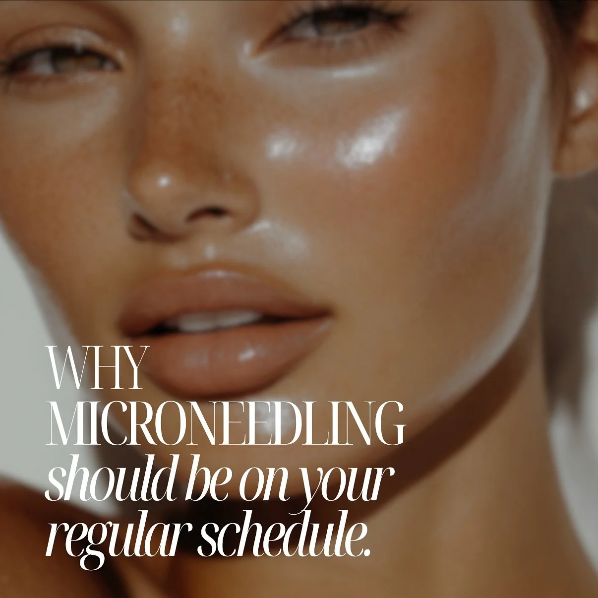 M I C R O N E E D L I N G 
Why Microneedling Should Be on Your Self-Care Schedule…
⠀⠀⠀⠀⠀⠀⠀⠀⠀
Your skin deserves more than just a good cleanser
Microneedling is the ultimate game-changer for glowing, youthful skin, and here’s why you&rs