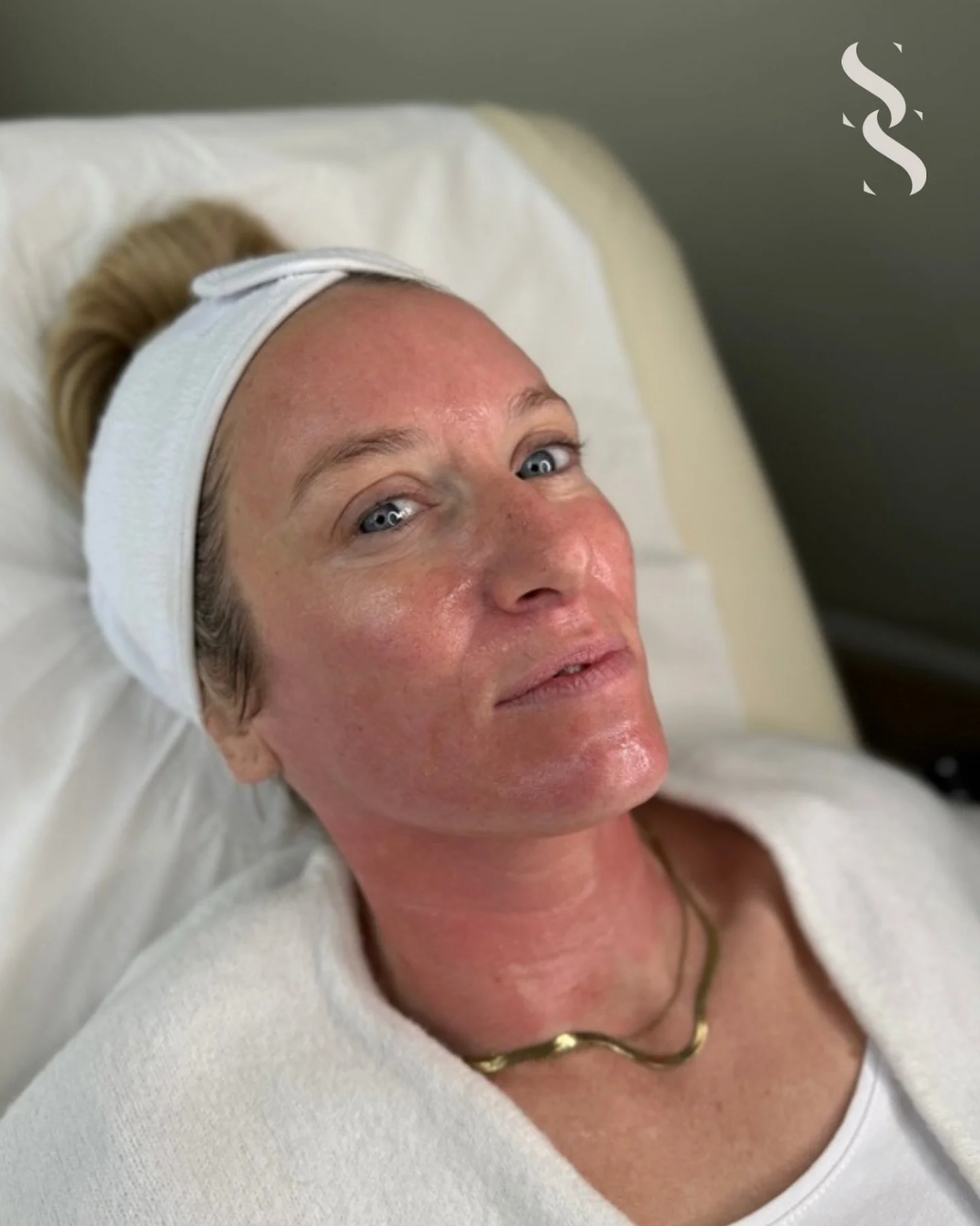 ~ E X O S O M E S ~
Microneedling with Exosomes ✨
Exosomes are powerful regenerative messengers that supercharge your skin’s repair process - giving you faster, more visible results than microneedling alone
Perfect for: dull skin, acne scars