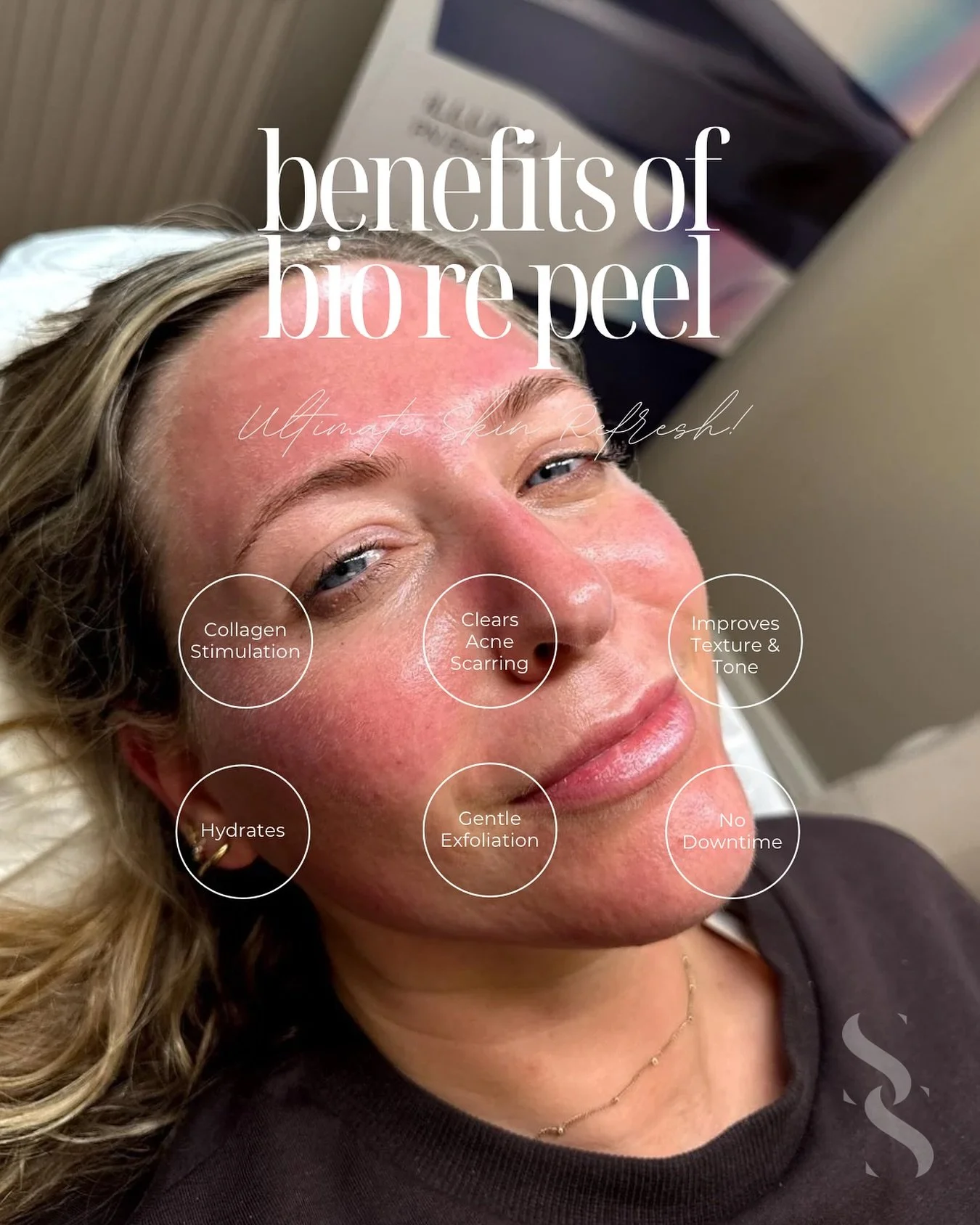 BioRePeel 🧪

Ultimate Skin Refresh, unlocked ✨

Our BioRePeel treatment brightens dull skin with powerful active ingredients that work beneath the surface. 

Benefits:

💫 Collagen Stimulation 
💫 Clears Acne Scarring 
💫 Improves Texture &amp; Tone