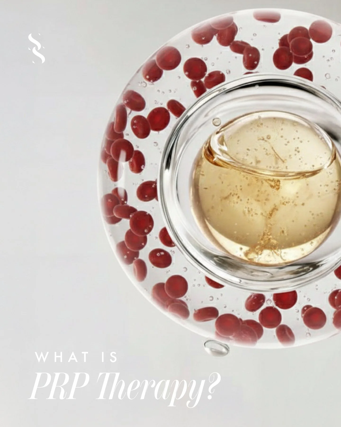 P R P  Therapy 🩸✨

PRP therapy is a regenerative treatment that works with your body&rsquo;s own natural processes to support skin repair and renewal.

Using a small sample of your own blood, the platelets are carefully concentrated and then applied