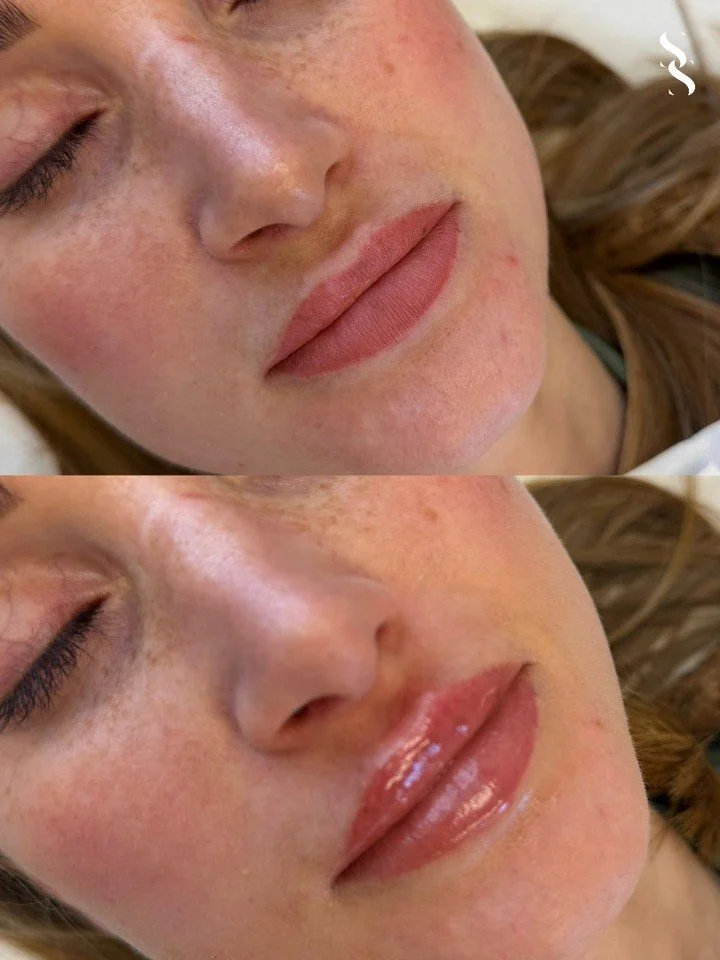 Different clients. Same approach. Consistent results 💋

Every set of lips is unique, which is why no two treatments are ever the same.

Our focus is always on enhancing natural shape, improving balance and creating a soft, hydrated finish that compl