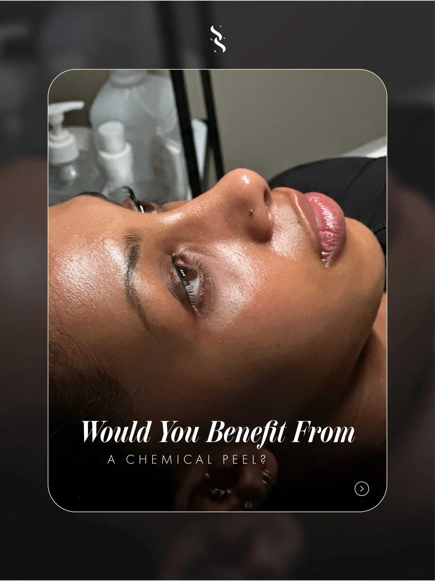 ✨ Would your skin benefit from a chemical peel?

Chemical peels are designed to improve overall skin clarity and texture by encouraging healthy skin cell turnover.

But not every peel is the same, different strengths and depths are chosen depending o